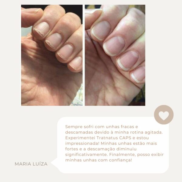 CAPS Hair Essential Beauty (próximo do vencimento- vence em Setembro 2025) - Imagem 4